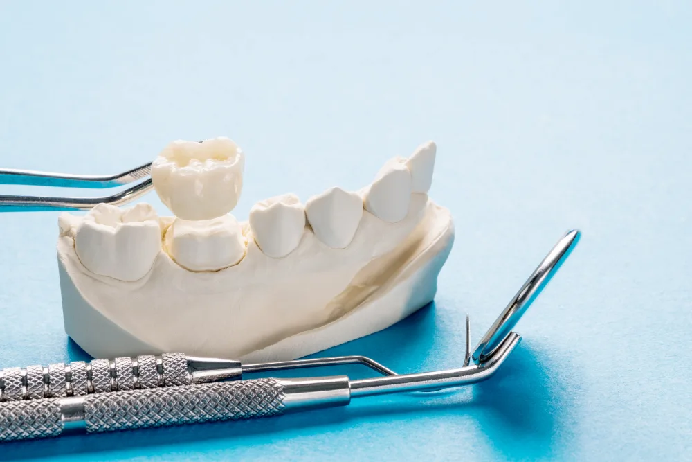 Corona dentale