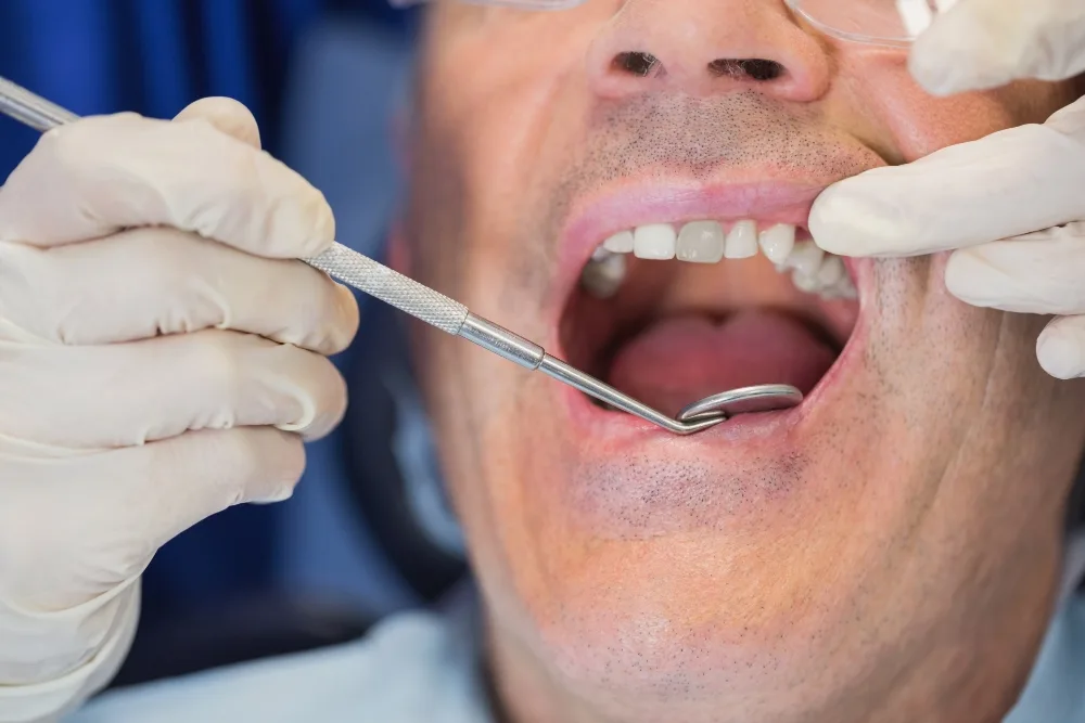 Dente Annerito - Dentista Roma Centro