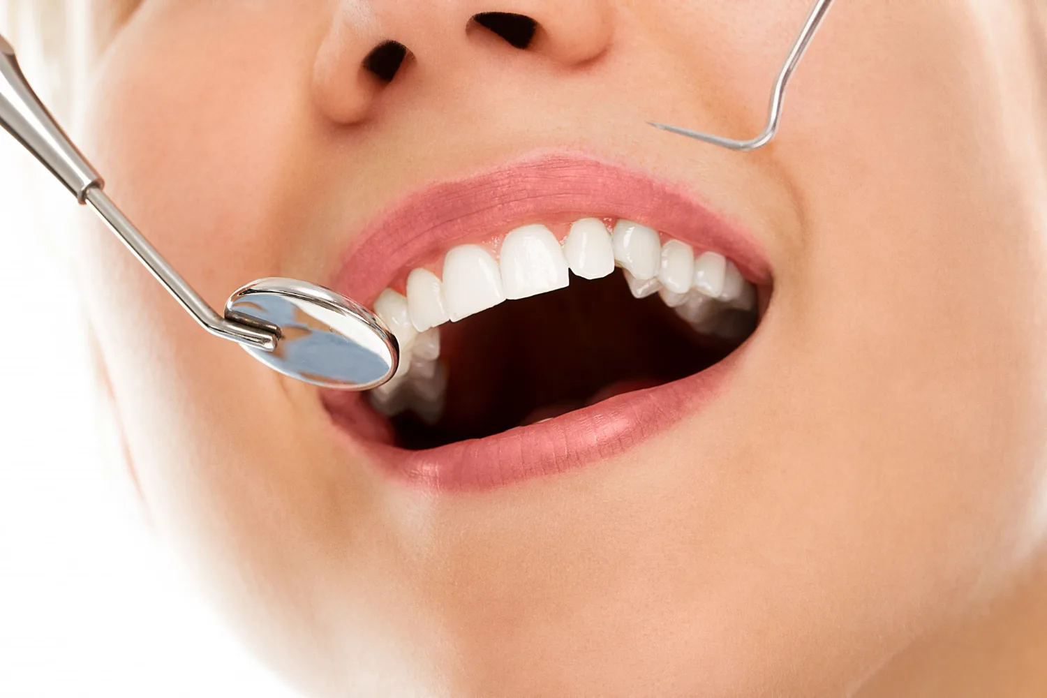 Prevenzione dentale con la Fluoroprofilassi - Dentista Roma
