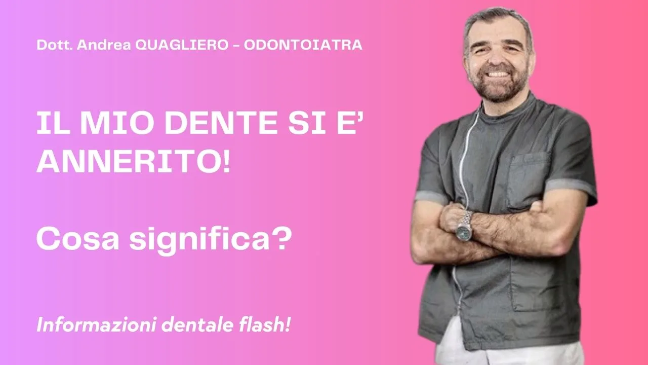 Dente annerito