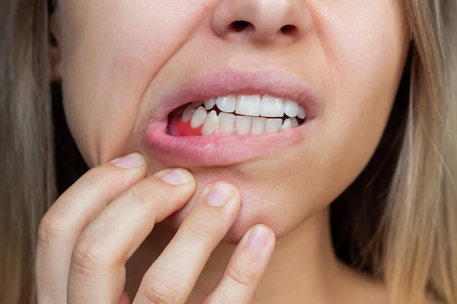 Prevenzione Parodontite Roma - Studio Dentistico