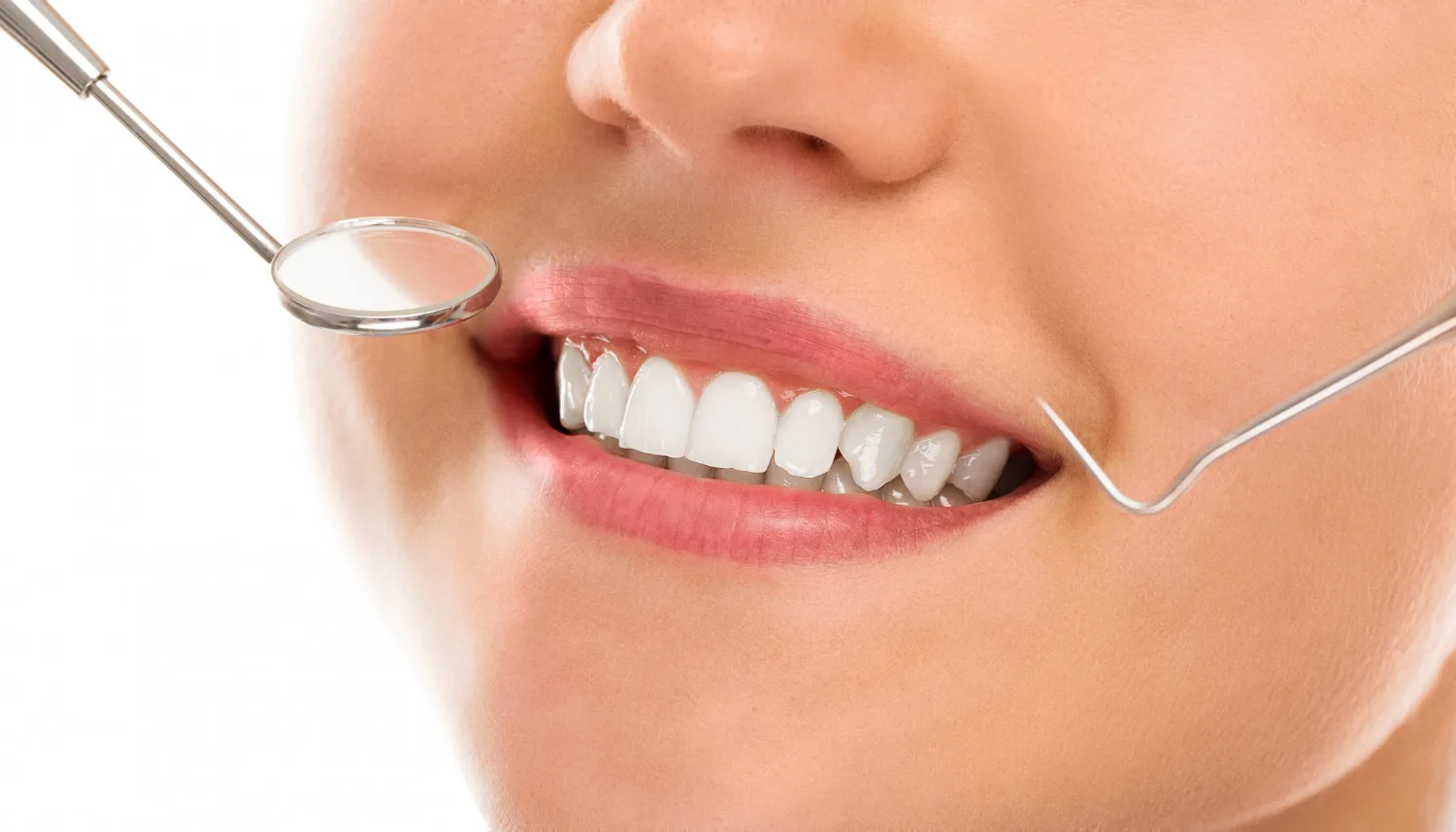 Prevenzione dentale Roma