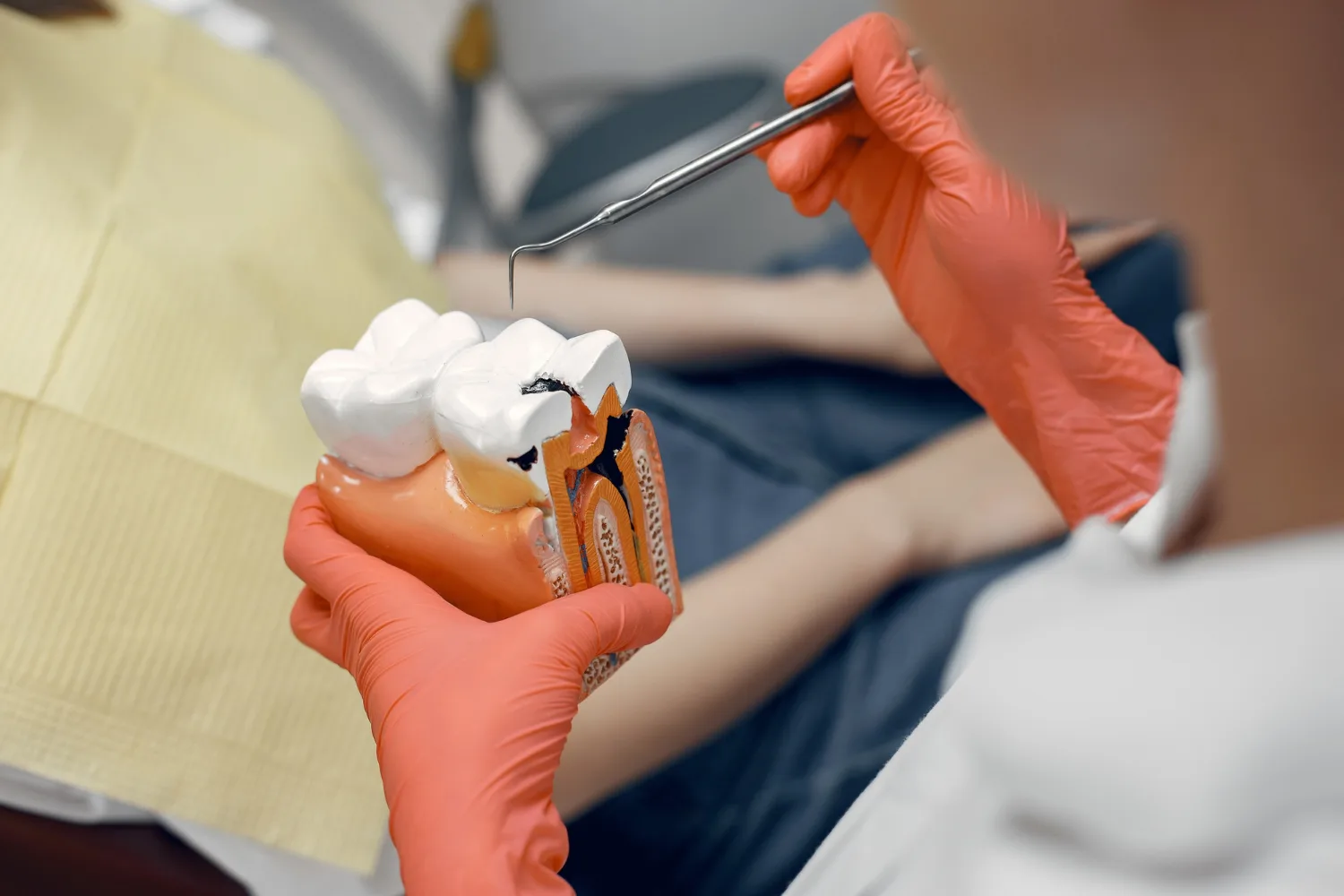 Carie e prevenzione dentale!