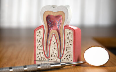 Endodonzia: quando e perché è necessario il trattamento canalare