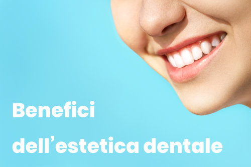 Benefici dell'Estetica Dentale