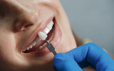 Faccette Dentali: Ritrova il Tuo Sorriso e la Fiducia in Te Stesso